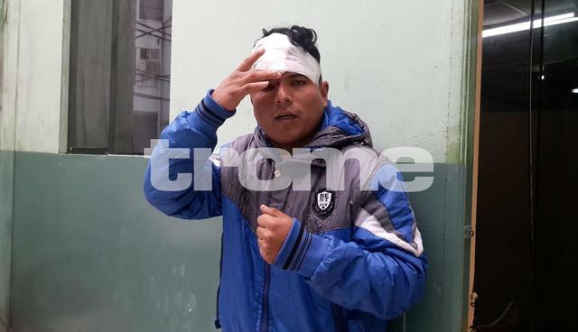 Matones golpearon brutalmente a ambulante por negarse a pagar 'cupo'. Foto: Mónica Rochabrum