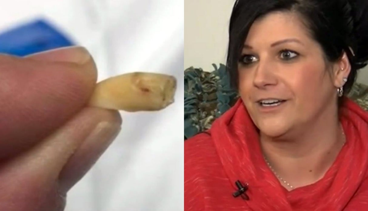 Mujer encuentra diente humano en bolsa de nueces