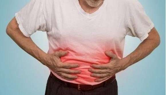 En el caso de una obstrucción intestinal debida a una hernia, el intestino comprometido puede perder la vitalidad y ser necesario cortar parte del intestino. Foto: Pexels.