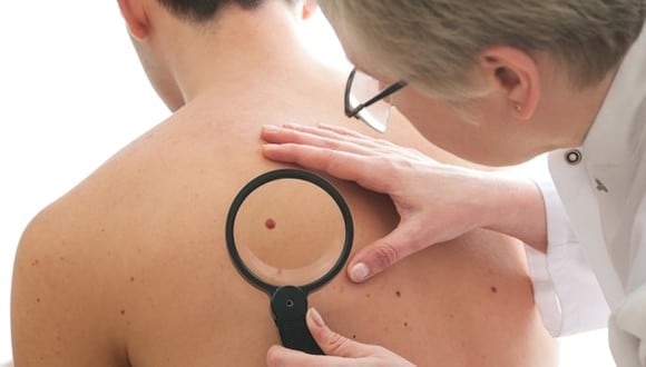 La Roche–Posay lanza SkinChecker Tour, campaña que promueve la revisión y monitoreo de lunares de manera gratuita a cargo de dermatólogos.
