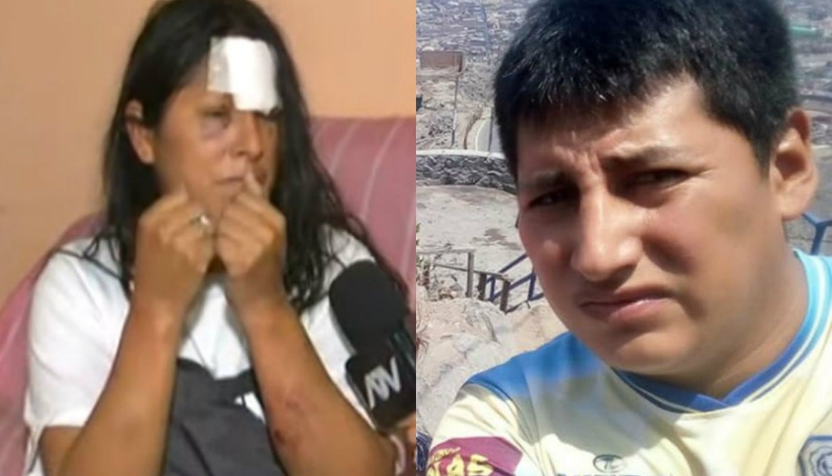 Maldito desfiguró a la madre de sus hijas con un fierro porque se negó a volver con él. Foto: Captura de ATV Noticias
