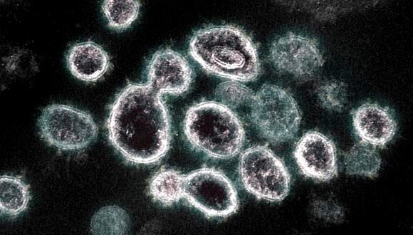 Esta imagen, cortesía del Instituto Nacional de Alergias y Enfermedades Infecciosas / NIH, muestra una imagen de microscopio electrónico de transmisión del SARS-CoV-2, el virus que causa el Covid-19, aislado de un paciente en los EE. UU. (Foto: National Institute of Allergy and Infectious Diseases / AFP)