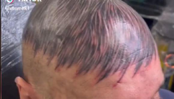 Sujeto se tatuó la cabeza con cabello falso. (Foto: @vtweek1 / TikTok)
