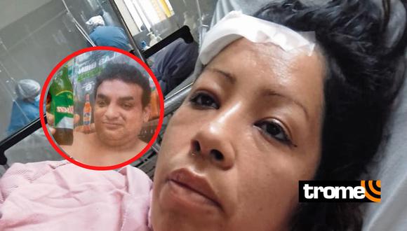 Wuilliams Eduardo Balabarca Jara (42), cegado por los celos atacó a su expareja Lisbeth Manco Salazar (40). (Foto: Trome)