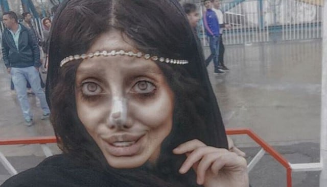 Sahar Tabar de 19 años se deformó el rostro por querer parecerse a Angelina Jolie. Foto: Instagram