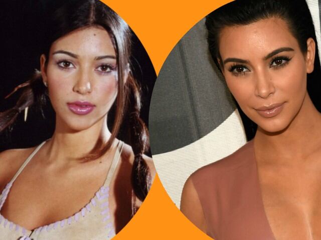 Kim Kardashian antes y después.