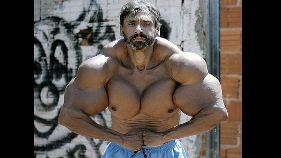 Albañil de Brasil se inyecta para ser como ‘Hulk’.
