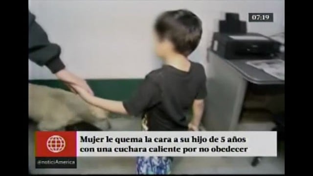 Mujer le quema la cara a su hijo de 5 años por desobedecerla en Chiclayo.
