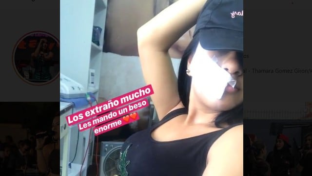 Thamara Gomez luce su rostro por primera vez luego de accidente con hacha