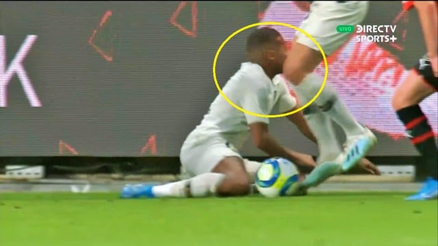 Kylian Mbappé recibió tremendo golpe en la cabeza que lo dejó conmocionado unos instantes