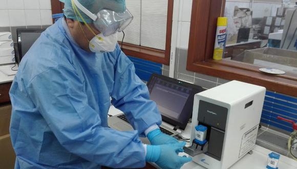 Cusco: Hospital de EsSalud Cusco realizará pruebas moleculares para COVID-19 y dará resultado en tres horas. (Foto: EsSalud)