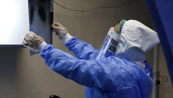 Un médico revisa una radiografía (Foto referencial: LOUAI BESHARA / AFP)