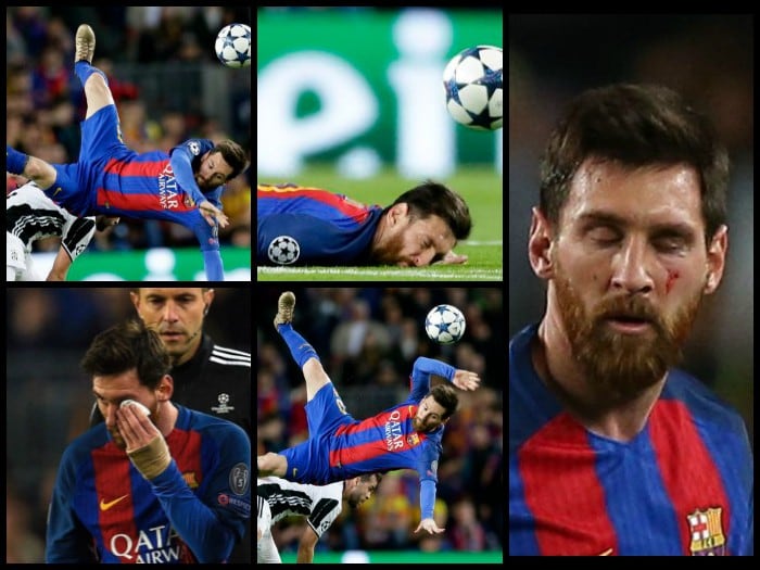 Lionel Messi: CUADRO x CUADRO de su aparatoso costalazo de cara contra el césped en la Champions League