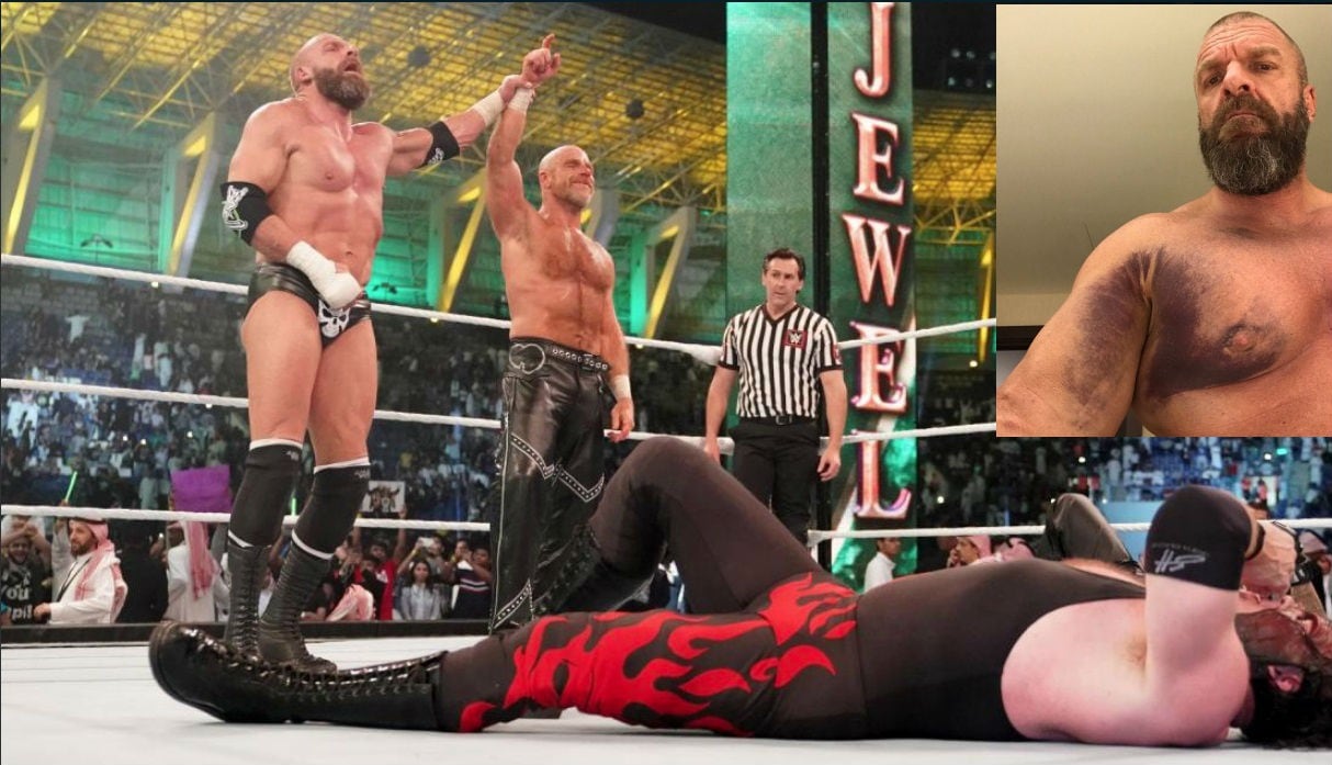 Pese a la victoria junto a Shawn Michaels, Triple H deberá ser sometido a una intervención quirúrgica. (WWE)