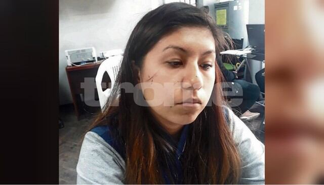 Inseguridad ciudadana: Le corta la cara a joven y le roba su celular en San Martín de Porres