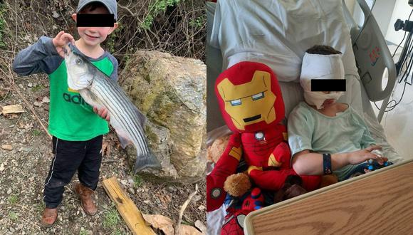 El pequeño Dominick Krankall, de 6 años, sufrió quemaduras de segundo y tercer grado en su rostro y partes del cuerpo. (Foto: Twitter)