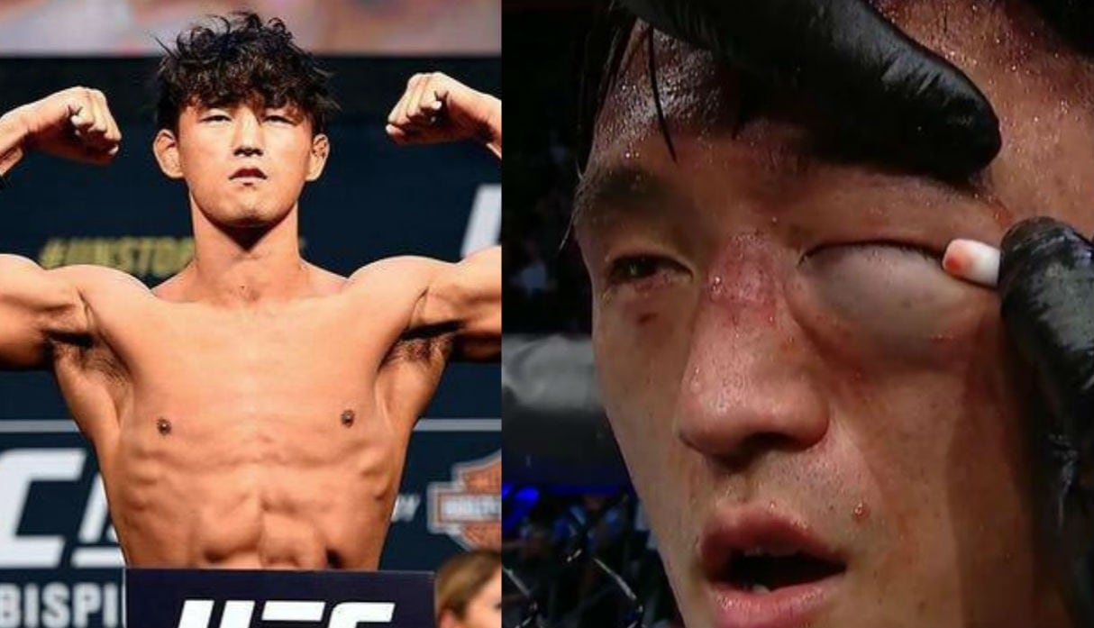 Dong Hyun Ma terminó con el ojo izquierdo así, como consecuencia de paliza en el UFC. (Agencia/ Redes sociales)