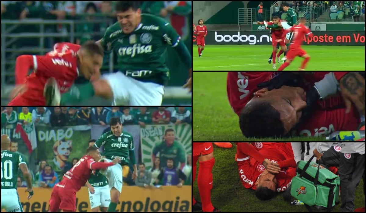 Paolo Guerrero recibió brutal patada en la cara en el Internacional vs Palmeiras por Copa de Brasil
