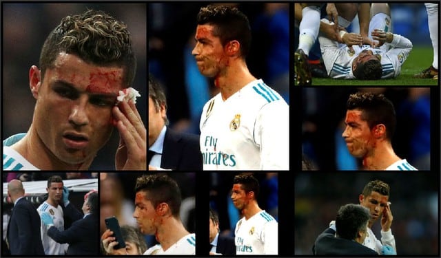 Cristiano Ronaldo anotó el gol más doloroso y sangrante de su carrera ¿Qué cosa? [FOTOS y VIDEO]