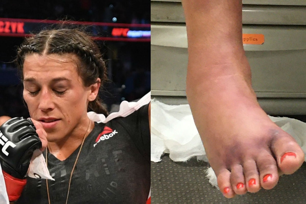 Así terminó el pie derecho de Michelle Waterson. (UFC/ Twittter Ariel Helwani)