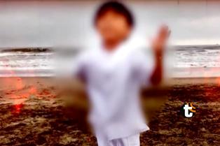 Niño quemado en sesión de fotos es operado por segunda vez: Este es su estado