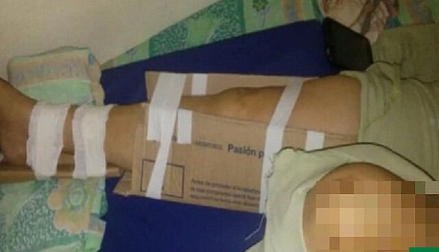 Hospital se quedó sin presupuesto y 'enyesó' a una paciente con cartón y cinta de embalar. (Fotos: Facebook)