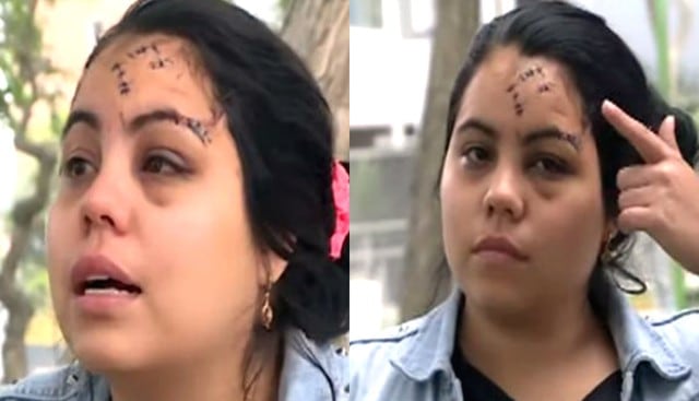 Venezolana queda con el rostro desfigurado tras brutal ataque de su ex amiga