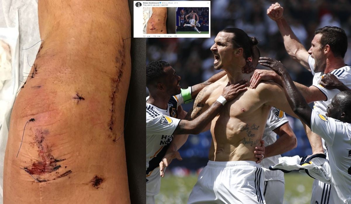 Zlatan Ibrahimovic y su revancha desafiante: Publica y recuerda terrible foto de rodilla tras brillar en MLS