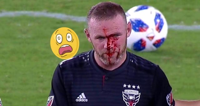 Así quedó el rostro de Wayne Rooney luego de anotar su primer gol en la MLS