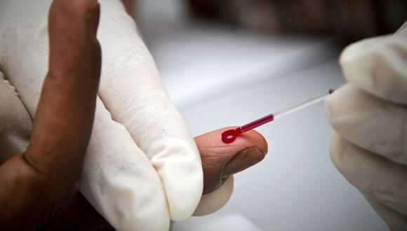 Un médico voluntario del Centro de Recepción de Atención y Orientación de Cayenne (CASOM) realiza una prueba rápida de detección del VIH el 6 de abril de 2010 en Cayenne, Guayana Francesa. (Foto de Jody AMIET / AFP)