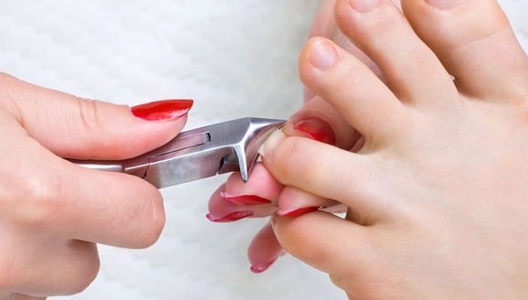 Se debe cortar las uñas de los pies apropiadamente ya que de lo contrario podemos provocarnos una uña enterrada o una infección en el pie (Foto: Pixabay)