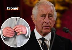 Rey Carlos III: ¿por qué tiene ‘dedos de salchicha’ y a qué se debe?