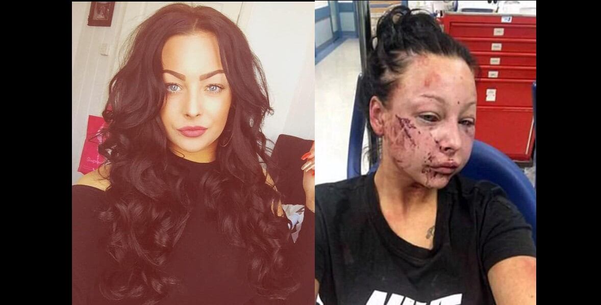 Una bella joven fue golpeada brutalmente por su novio y padre de su hijo. La modelo hoy teme por su vida y está escondida. (Fotos: Instagram/Policía de Newport, Gales del Sur)