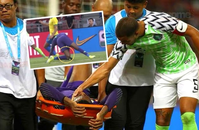 Arquero de Nigeria sufrió terrible rotura de ligamentos de la rodilla izquierda