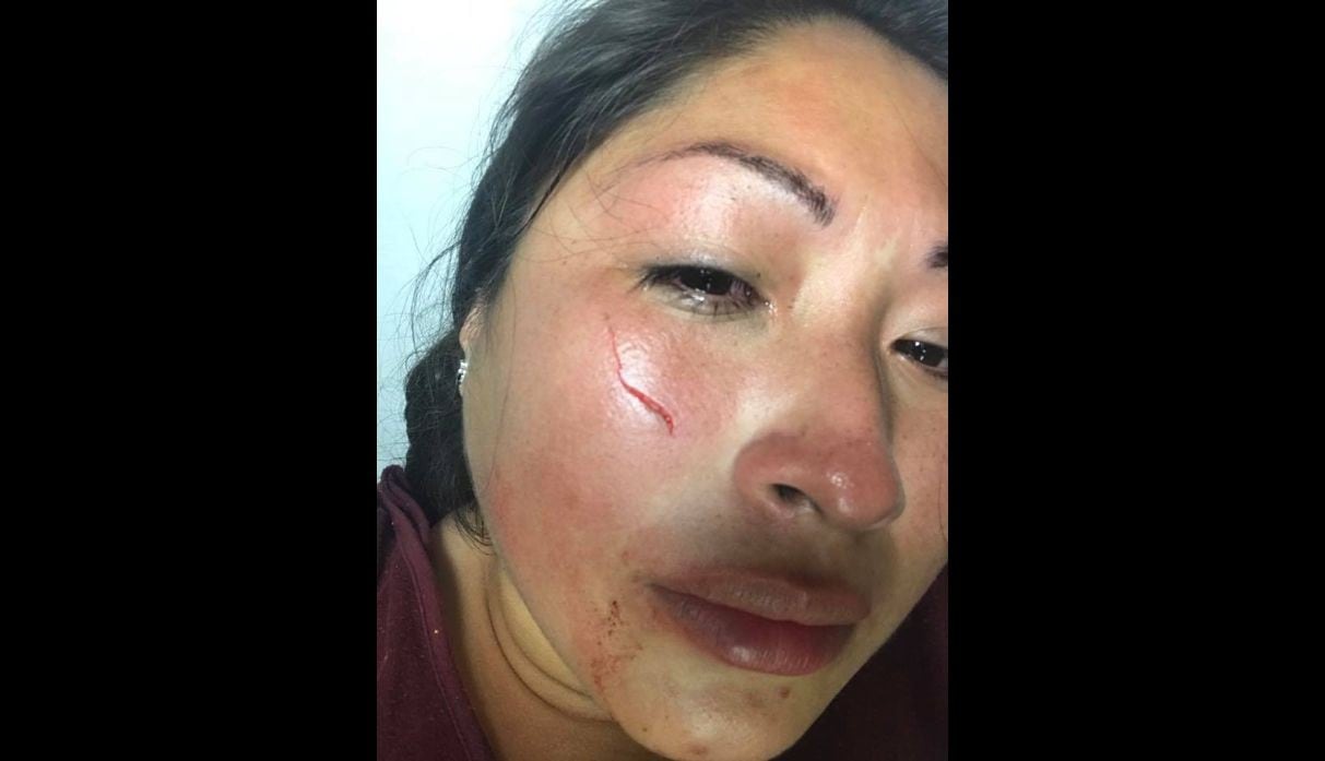 Inesita Casas Robles denunció que su expareja la agredió en San Borja mientras caminaba con su bebé de 10 meses.