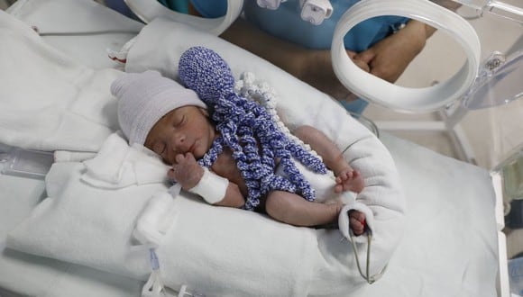 Implementan programa de soporte con prendas de lanas que permite evolución favorable de bebes prematuros. (Foto: EsSalud)
