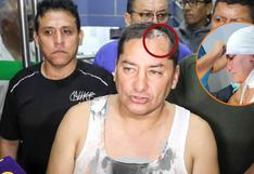 Alcalde de Comas sufre atentado por parte de delincuentes: le rompieron la cabeza y robaron su camioneta