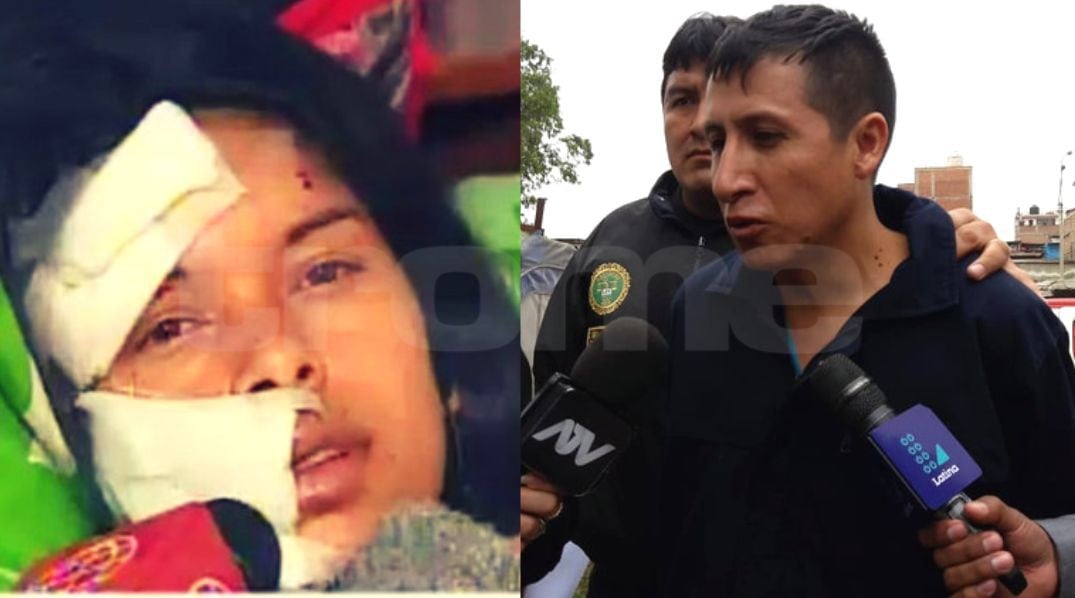 Villa El Salvador: Enfermero le cortó el rostro a su expareja con bisturí al interior de un bus