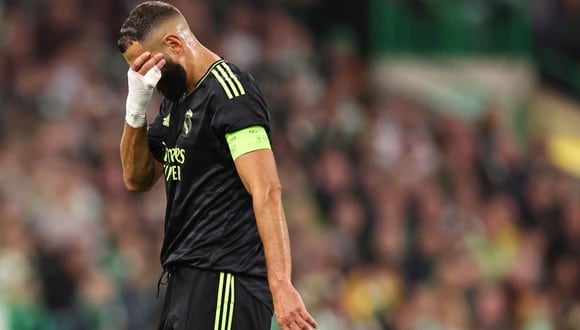 Karim Benzema salió lesionado en el Real Madrid vs. Celtic. (Foto: Agencias)