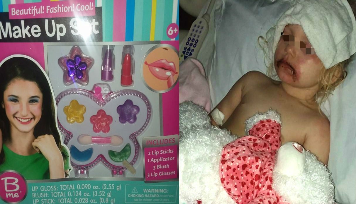 Niña fue internada de emergencia luego de jugar con maquillaje infantil