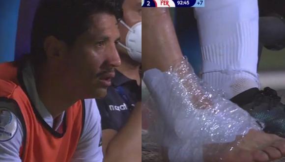Así terminó el pie del delantero peruano Gianluca Lapadula. (Captura América)