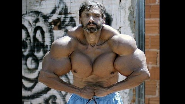 Albañil de Brasil se inyecta para ser como ‘Hulk’.