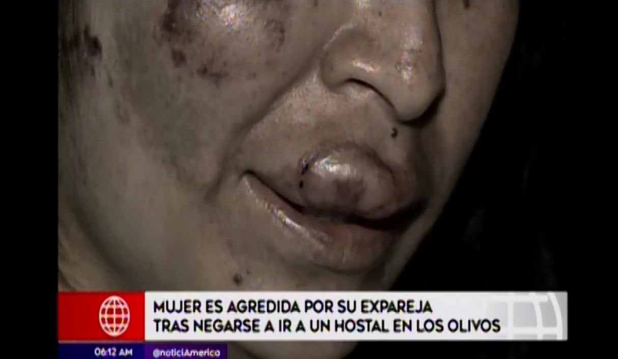 Andrea Aliaga denunció que Daniel Sare Vilcapoma, de quien se separó hace cuatro meses. (Captura: América Noticias)