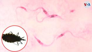 Enfermedad de Chagas: ¿Qué es y cómo se contagia?