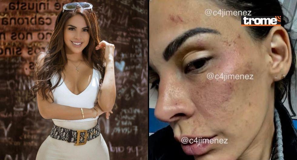 Stephanie Valenzuela quedó desfigurada tras recibir una brutal golpiza de su pareja Eleazar Gómez