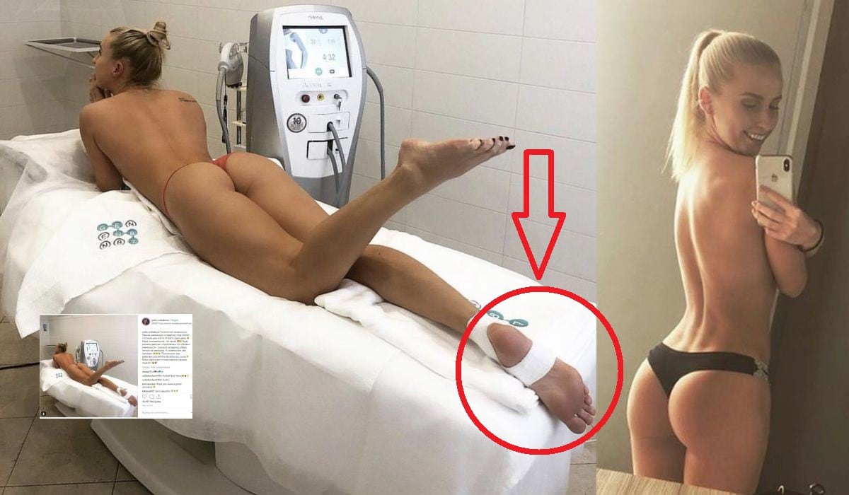 Instagram viral: Spartak: Infartante y sensual informe médico de lesión de jugadora en toples causa revuelo