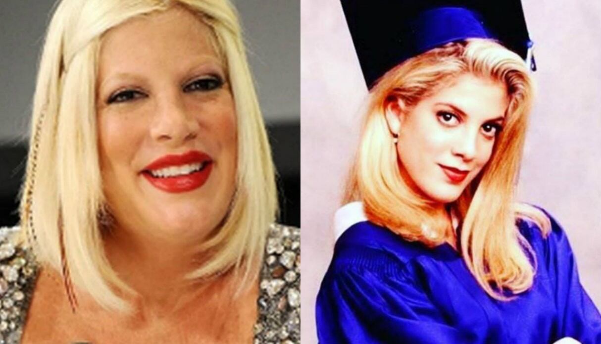 Actriz de Beverly Hills se deformó el rostro tras convertirse en adicta al botox