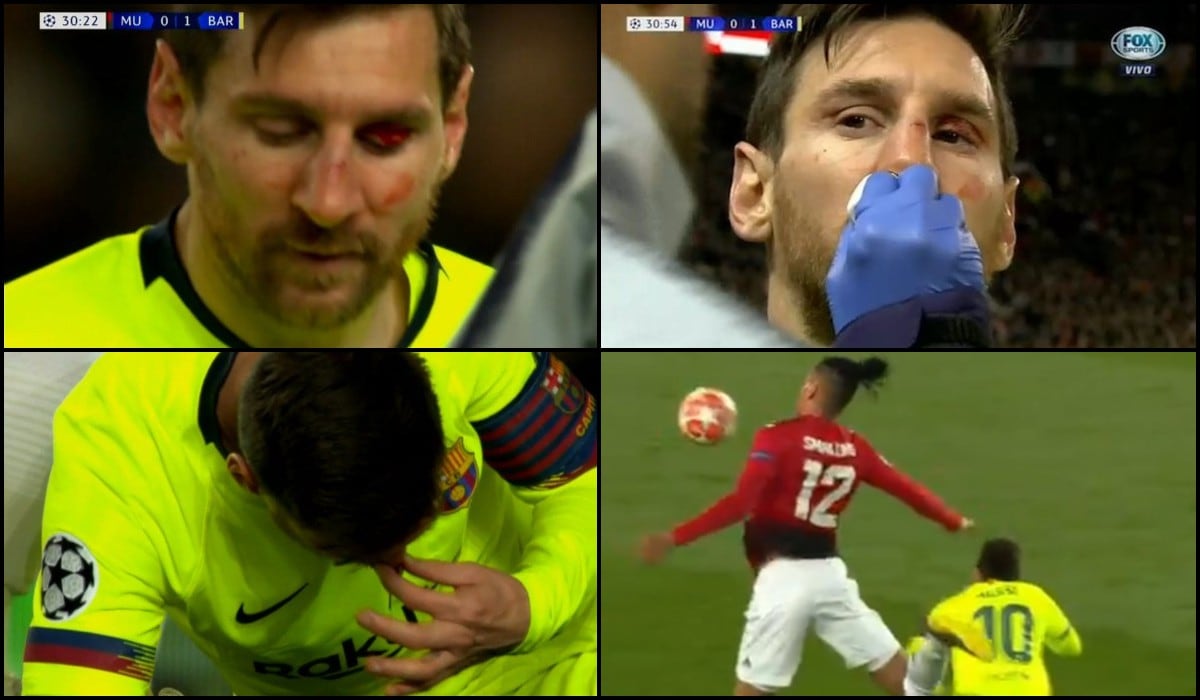 Lionel Messi bañado en sangre tras recibir manotazo en Barcelona vs Manchester United Video Champions