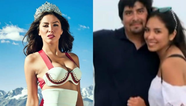 Ex Candidata a Miss Perú denuncia que su novio le rompió la clavícula el día de su cumpleaños