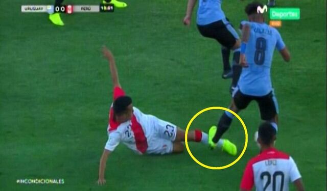 Ángelo Tandazo recibió violento pisotón en Perú vs Uruguay por el Sudamericano Sub 20
